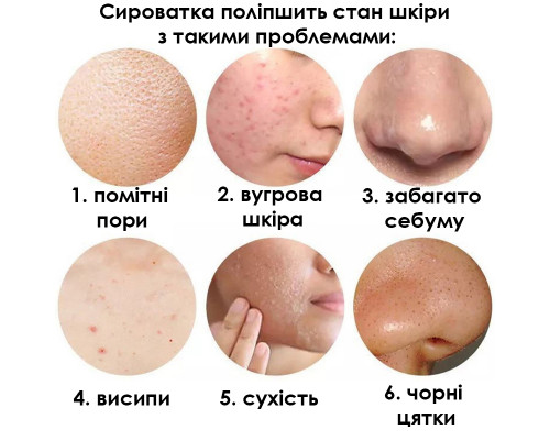 Сыворотка для лица SERSANLOVE Rose Essence 30 мл с экстрактом розы